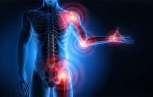 Infusiones y app para aliviar dolor articular