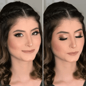 Ilumina tu Piel Naturalmente